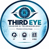 THIRD EYE trademark artwork